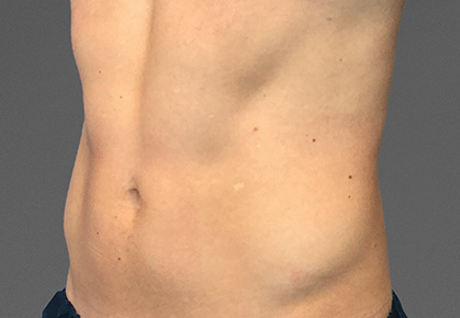 After Photo
